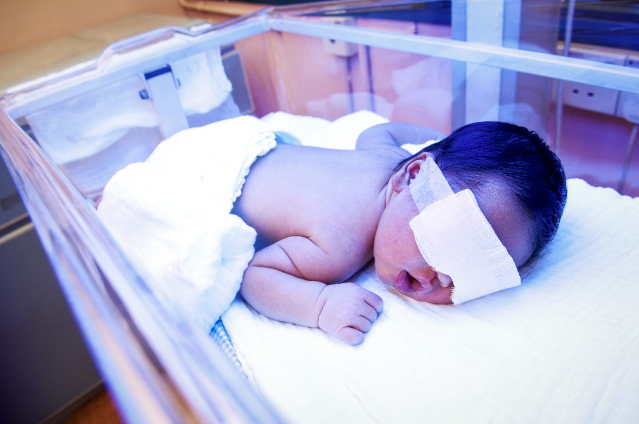 newborn-baby-with-jaundice-under-ultraviolet-light-2021-08-29-14-36-21-utc-1280x850.jpg